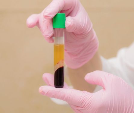 tube test plasma